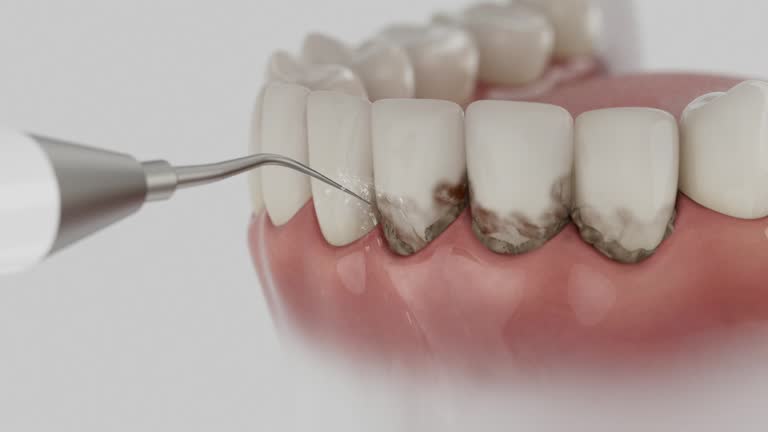 Trusted Dental Implants service in Mountain View, CA - Dentist Open Now